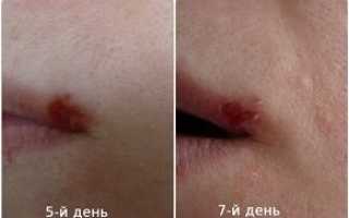 Аевит: для красоты, лечения и профилактики